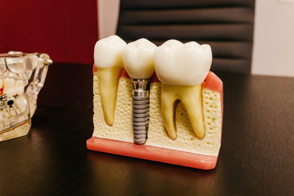 Explore Dental Treatments — dental treatment photography